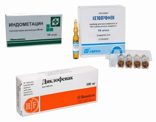 Как лечить артроз коленного сустава таблетки мази Как лечить артроз коленного сустава таблетки мази