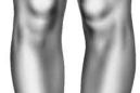Артрозо-артрит коленного сустава
