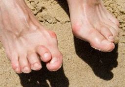 Почему болят суставы пальцев ног