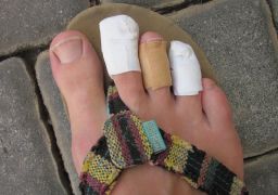 Почему болит палец на ноге около ногтя