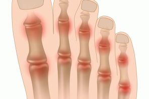 Почему болит ноготь на большом пальце ноги