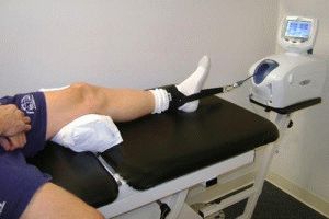 Гонартроз коленного сустава 3 степени