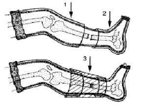 Лонгеты на суставы ног