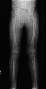 Рентген ног