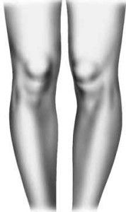 Артрозоартрит коленного сустава лечение