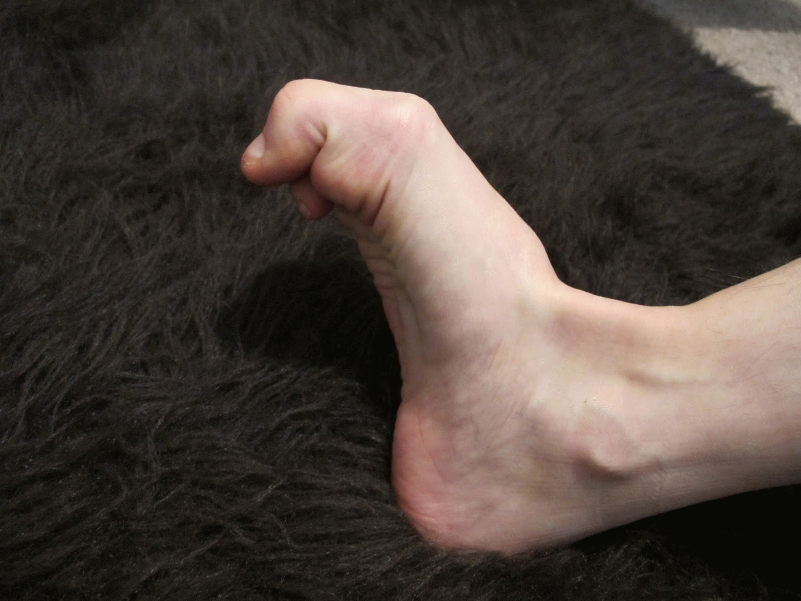 Судороги стопы и пальцев ног