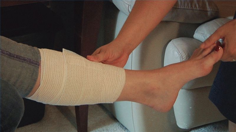 Как правильно бинтовать ноги после операции. Забинтовать ногу эластичным бинтом. Эластичный бинт на голень при варикозе.