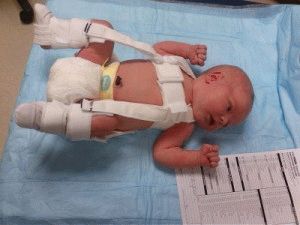 Изображение - Формирование суставов у новорожденных 21-300x225