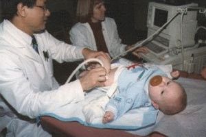 Изображение - Дисплазия тазобедренных суставов у младенца последствия 304-2-300x200