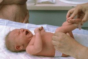 Осмотр тазобедренного сустава у малыша врачом